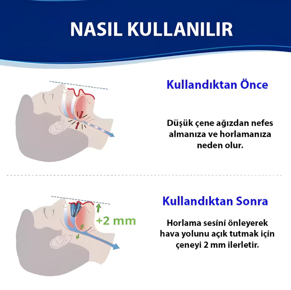 Ayarlanabilir Anti-Horlama Ağızlığı