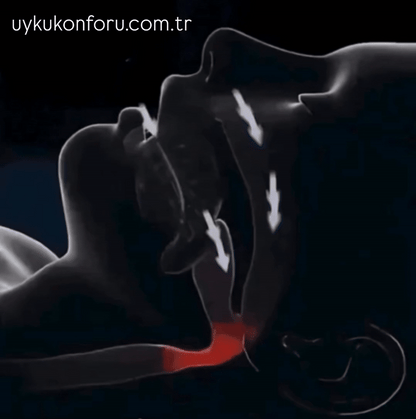 Ayarlanabilir Anti-Horlama Ağızlığı